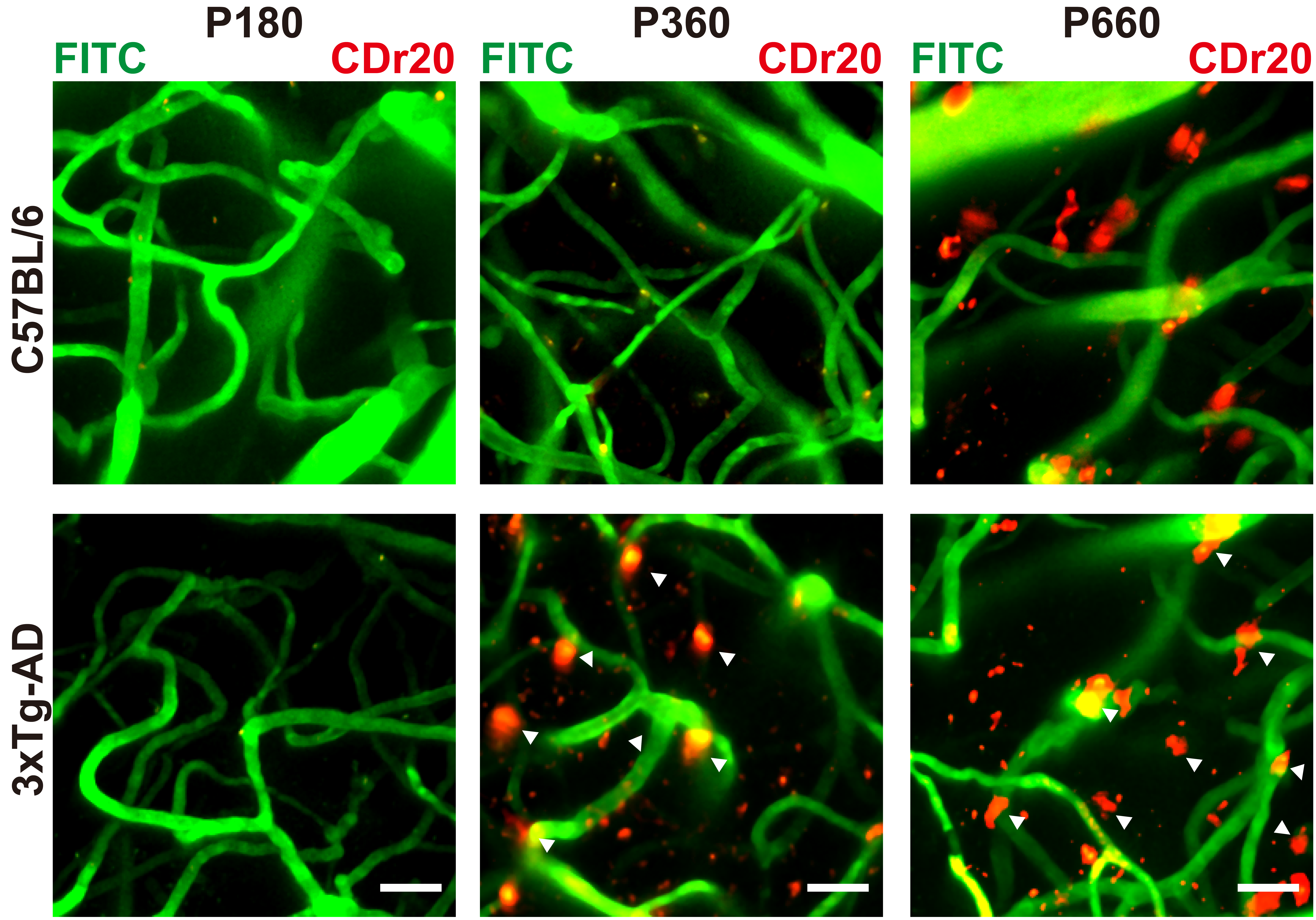 Baseline labelling of microglia by intravenous injection of CDr20 in aged mouse brains
