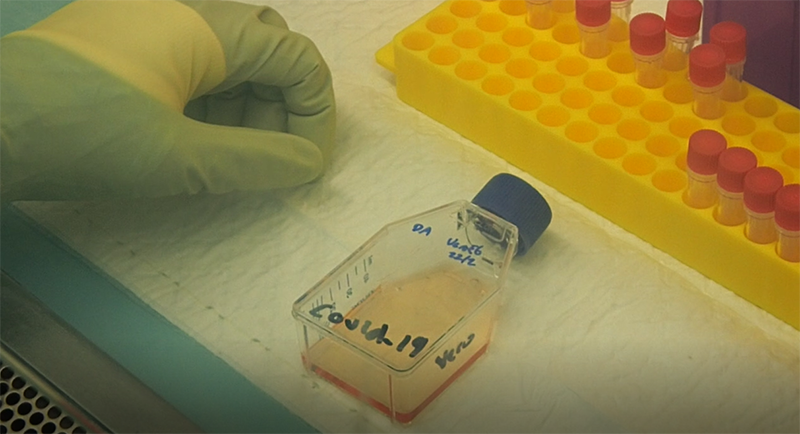 Sample of the COVID-19 virus
