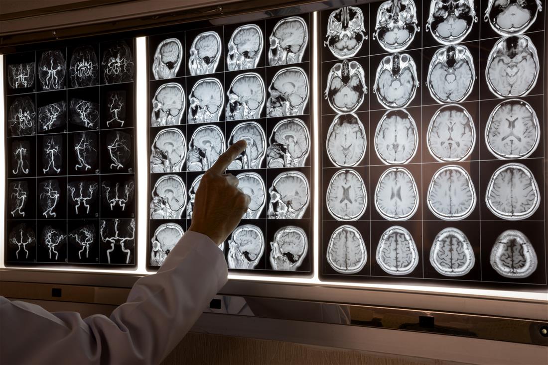 How long is the residency for a neurosurgeon?
