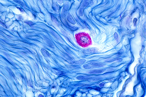 Close-up images of mast cells 