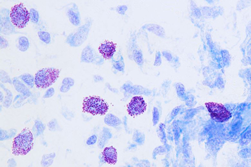 Close-up images of mast cells 