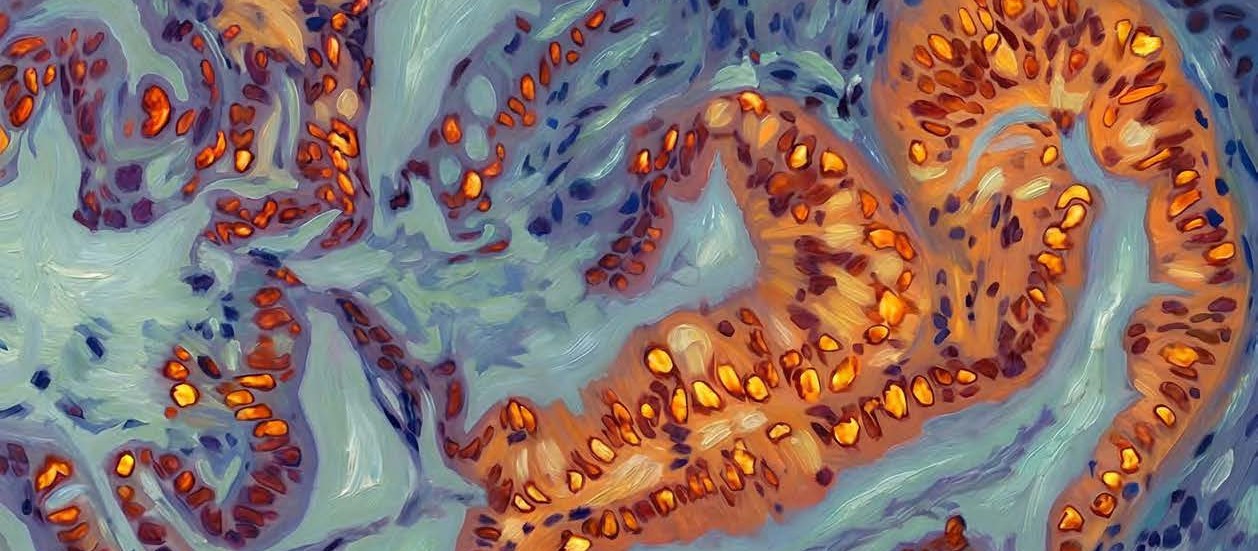 critical-role-of-oncogenic-kras-erk-junb (1)_cropped