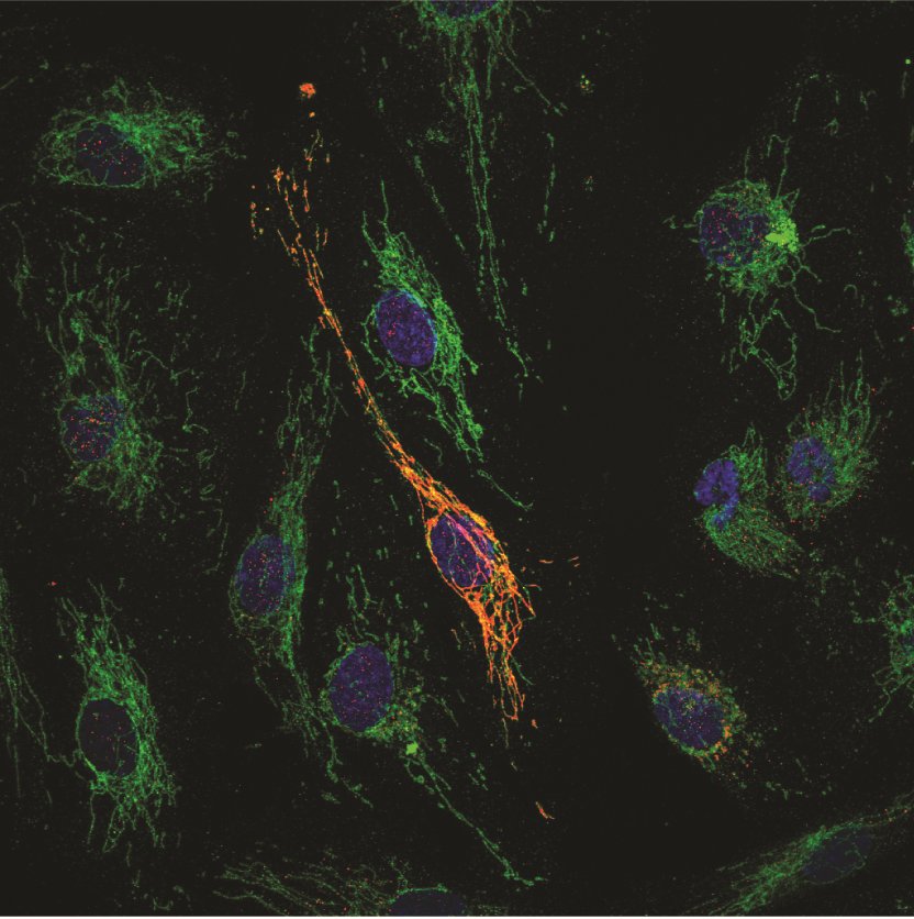 Microscope image showing colocalisation of MOCCI (red) with a mitochondrial protein (green) 