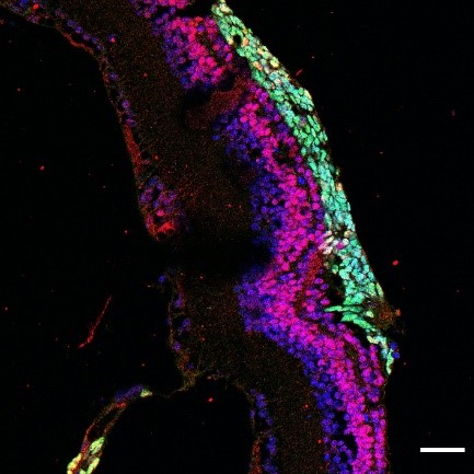 Engrafted photoreceptor progenitor cells (stained in green) in the host retina, resulting in improved visual function // Credit: Tay Hwee Goon