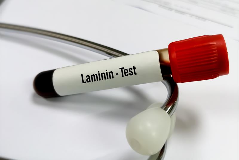 Laminins: Proteins with super power