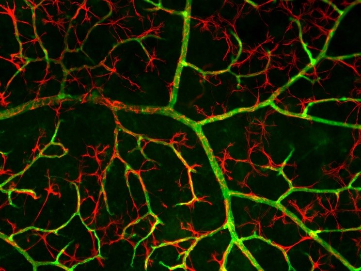 Retinal astrocytes (red) and retinal blood vessels (green) in the eye of an older mouse with mitochondrial dysfunction // Credit: Jonathan Crowston