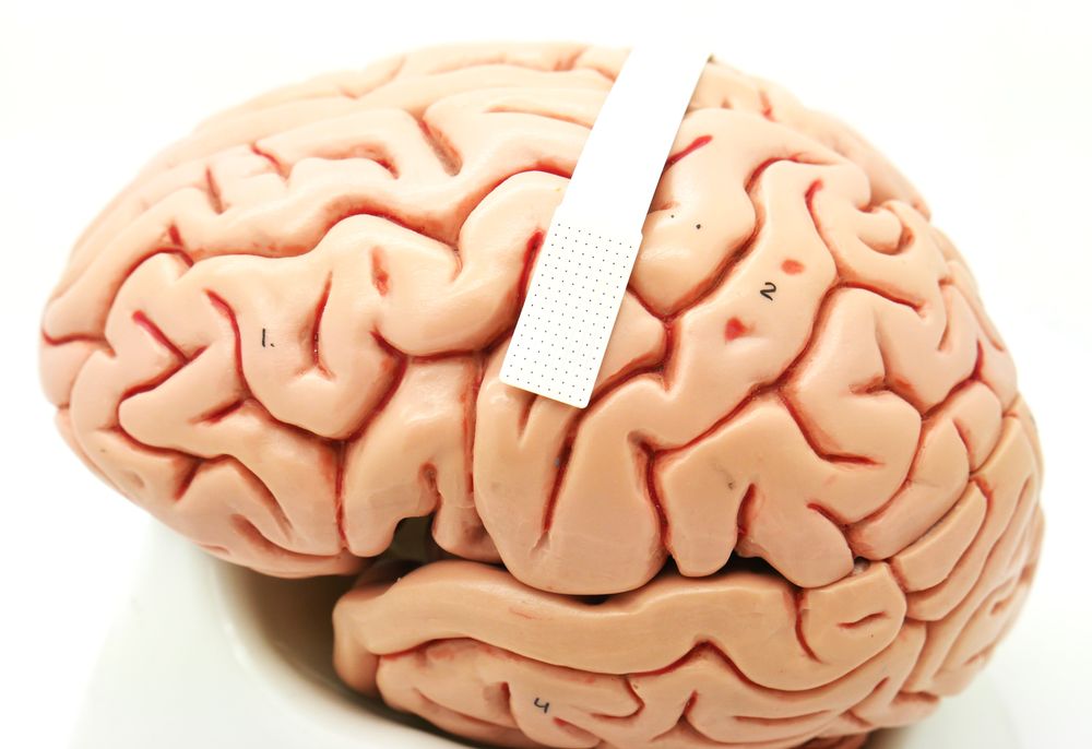 A model of a brain has a device placed across the middle of its two hemispheres. The device is no bigger than a postage stamp and packs 28 microscopic sensors that can translate brain cell activity into what someone intends to say