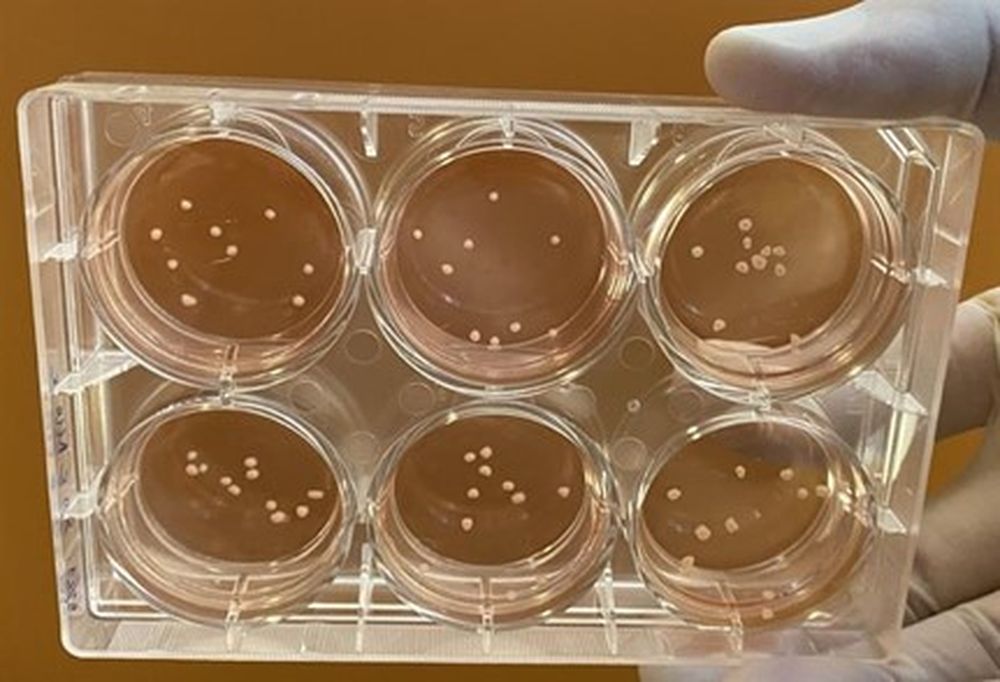 Midbrain-like organoids grown in Shawn Je&#39;s lab
