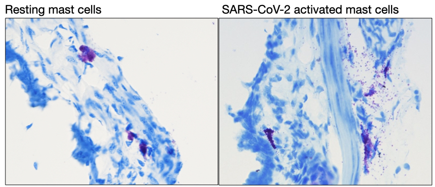 Mast cells degranulating in the trachea of a mouse infected with SARS-CoV-2 