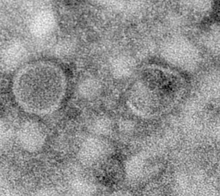 An electron microscopy image of extracellular vesicles secreted by muscles. // Image credit: Goh Kah Yong, Duke-NUS Medical School