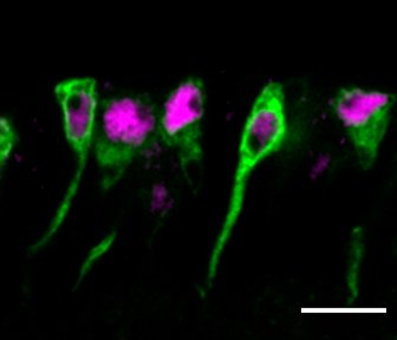 An image of NSCs from Drosophila larval brains
