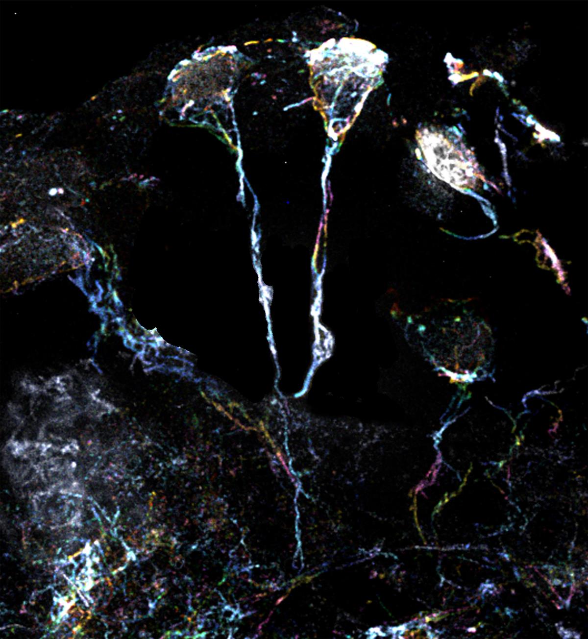 In the Drosophila brain In the Drosophila brain
