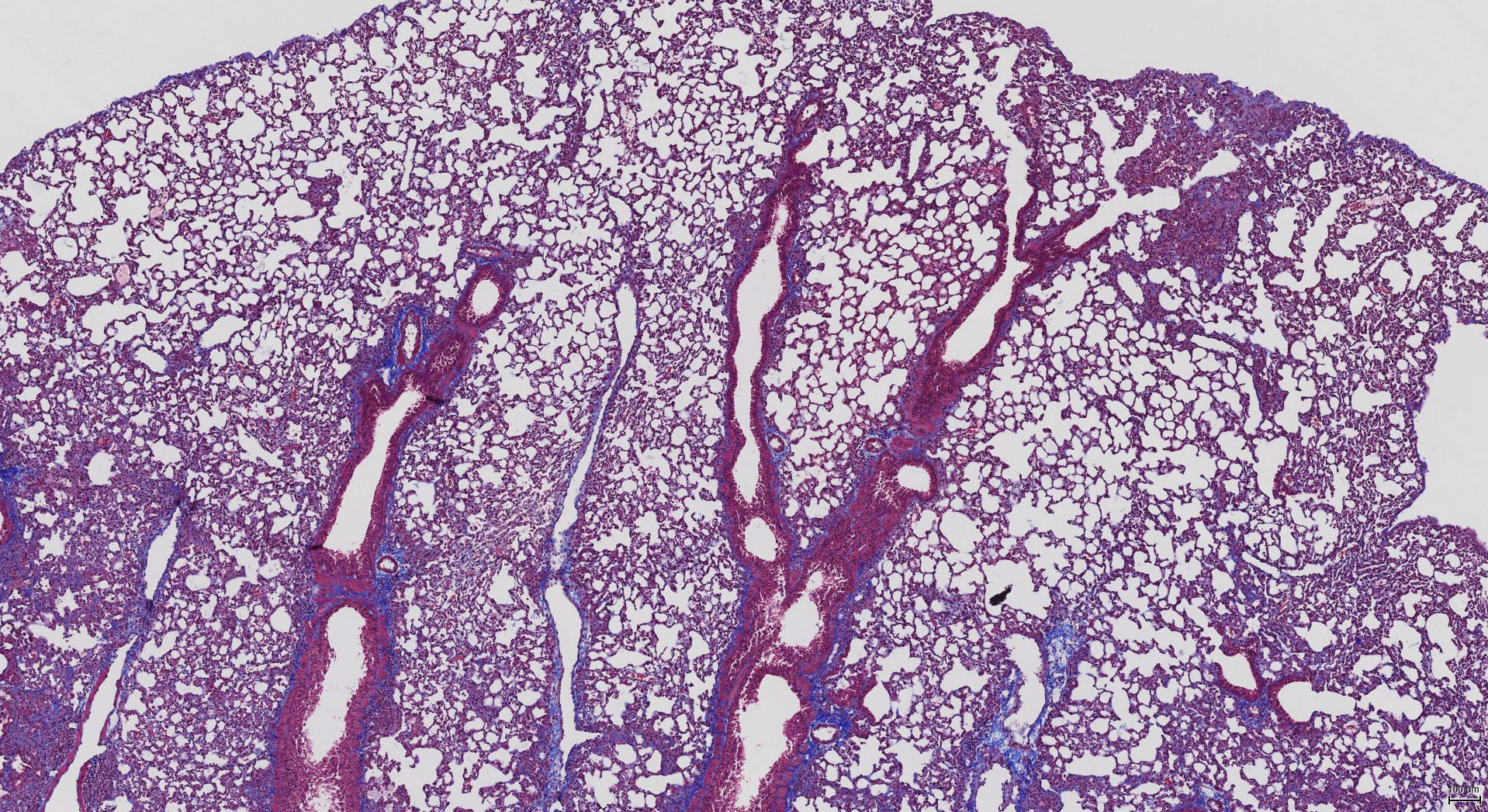 Histological imaging of fibrotic lung
