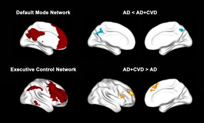 BrainFigurev2_compressed_0 BrainFigurev2_compressed_0