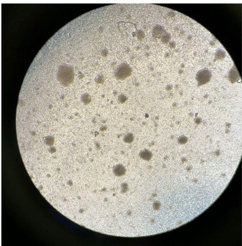 Clusters of T cells, that are part of our immune system protecting us against harmful pathogens, under a microscope. Clusters of T cells, that are part of our immune system protecting us against harmful pathogens, under a microscope.
