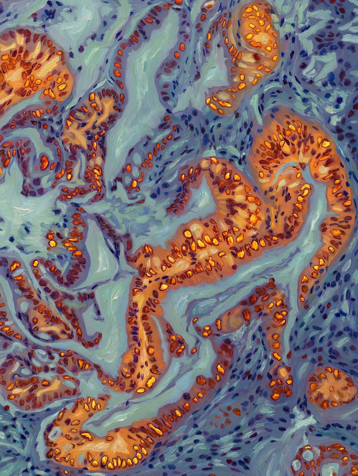 Zhong et al. report the critical role of oncogenic KRAS/ERK/JUNB signalling in suppressing GATA6