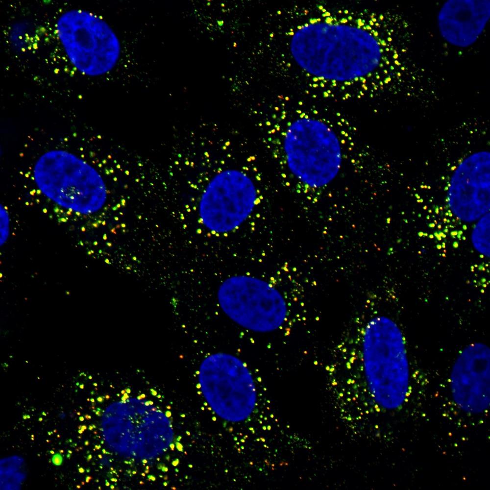 Duke-NUS Study Reveals How Dengue Rewires the Immune System, Reshaping Vaccine Response