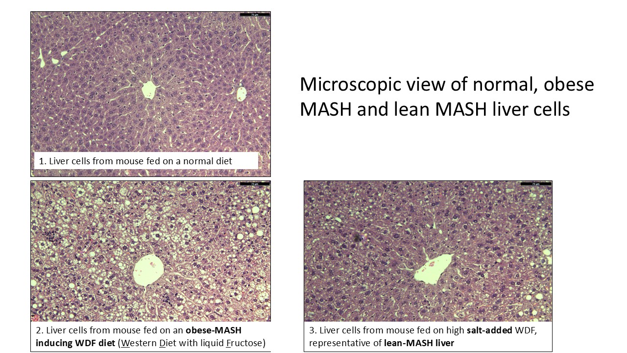 The cell images show that the high-salt diet causes MASH in both lean and obese mice, but via different mechanisms. // Credit: Duke-NUS Medical School