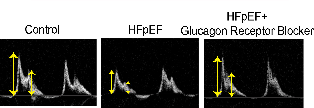 Images from electrocardiogram (ECG) tests to show heart function Images from electrocardiogram (ECG) tests to show heart function
