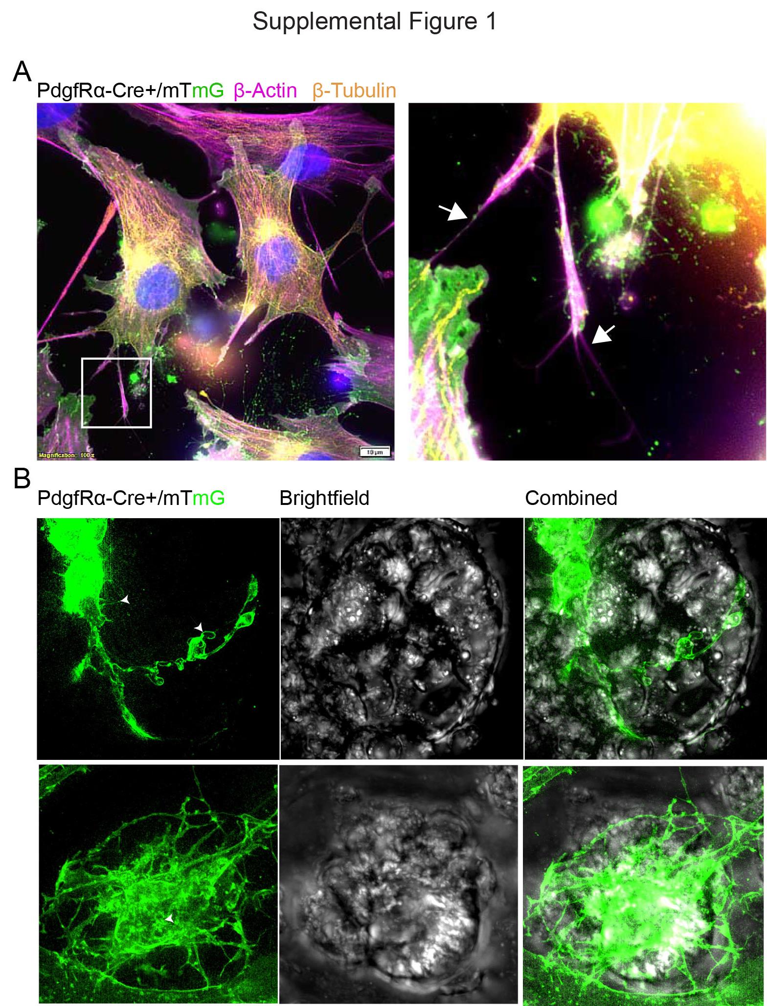 Intestinal telocytes send Wnt signals to nearby gut lining cells using long extensions and fine, finger-like projections.