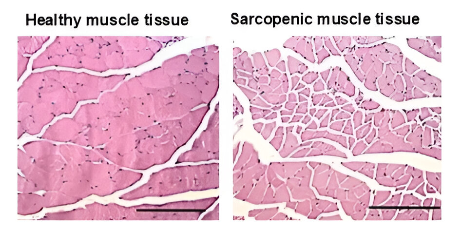 Healthy & Sarcopenic Muscle Tissues