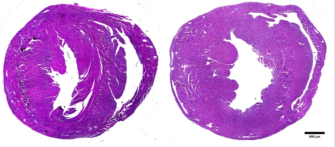 Cross section of heart 