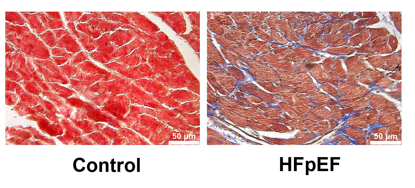 Heart tissue