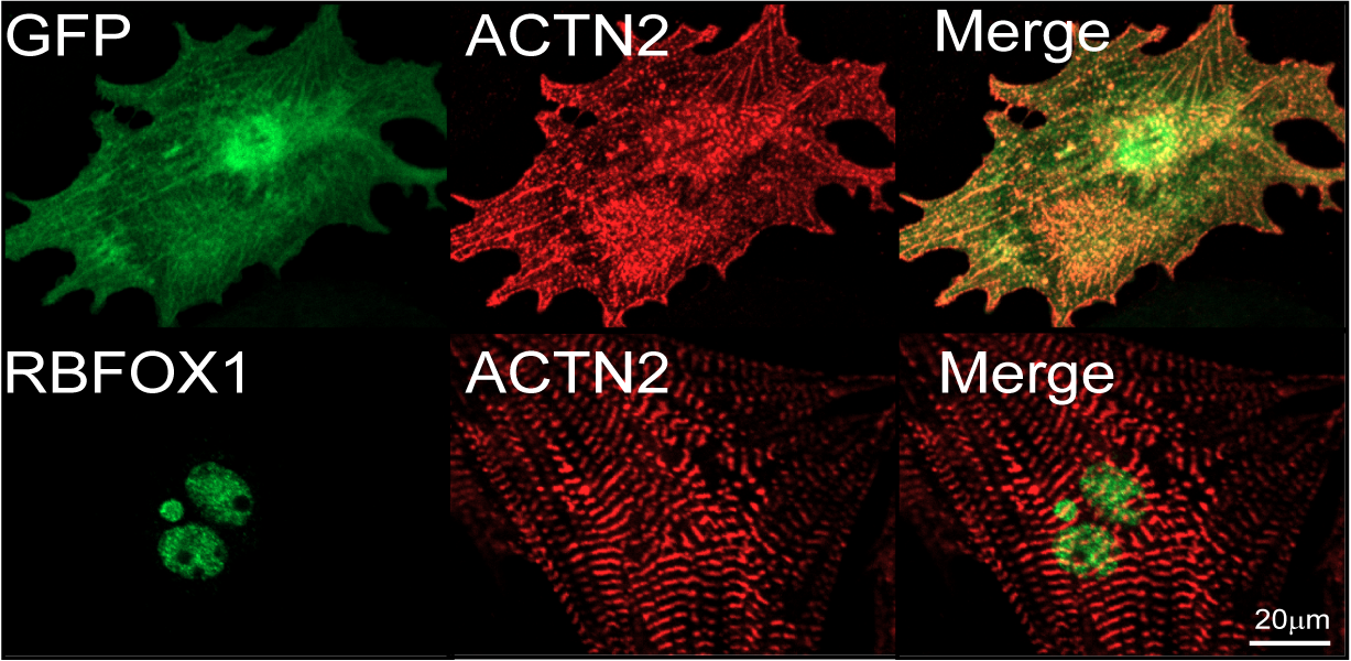 The top row depicts immature human heart muscle cells generated from stem cells. Their shape and fibre organisation is irregular.