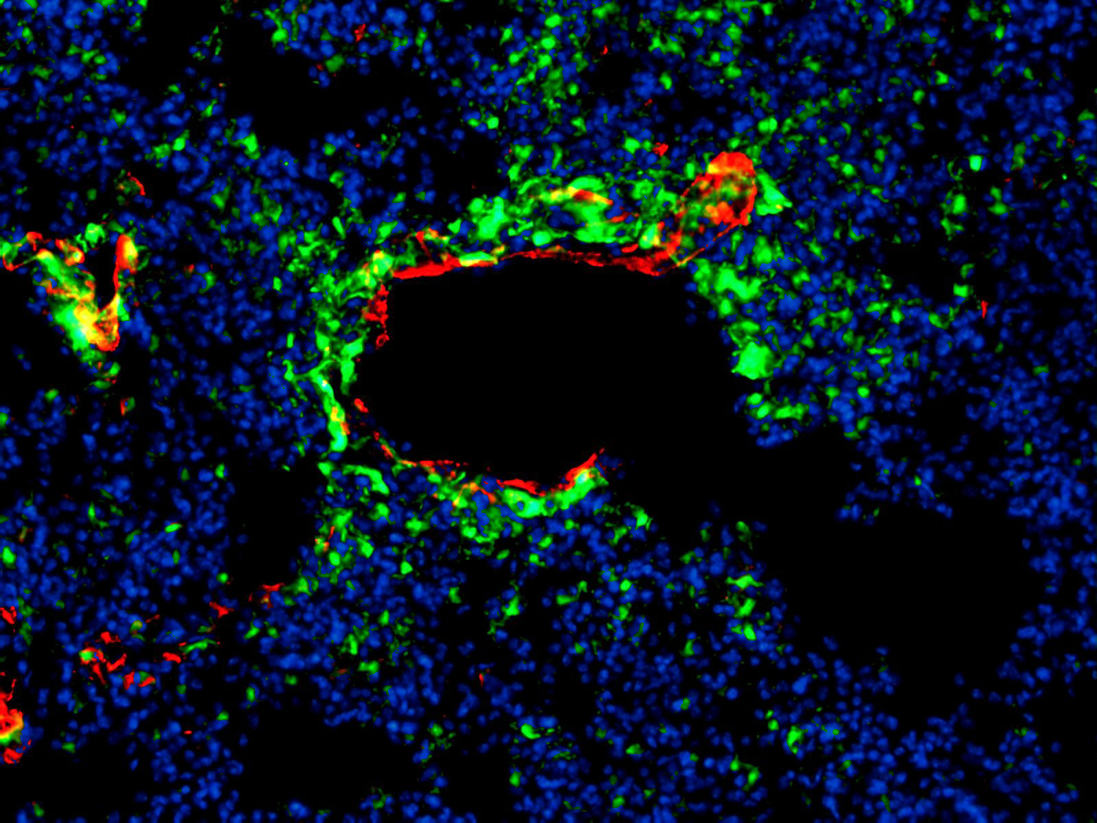 Fluorescence imaging of fibrotic lung