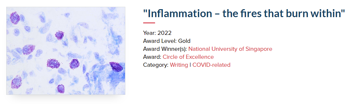 Kamini Kunasegaran receives Asian Scientist Lab Tech of the Year 2021 MiRXES COVID-19 Hero Award
