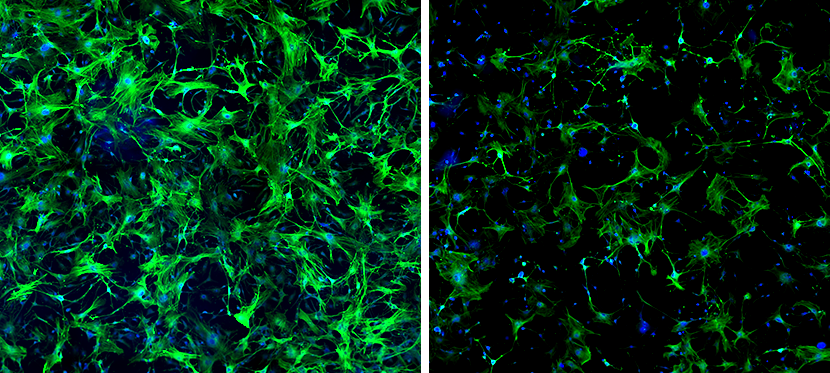 Macrophages lacking WWP2 greatly reduce the “triggering” of fibroblasts during the development of cardiac fibrosis