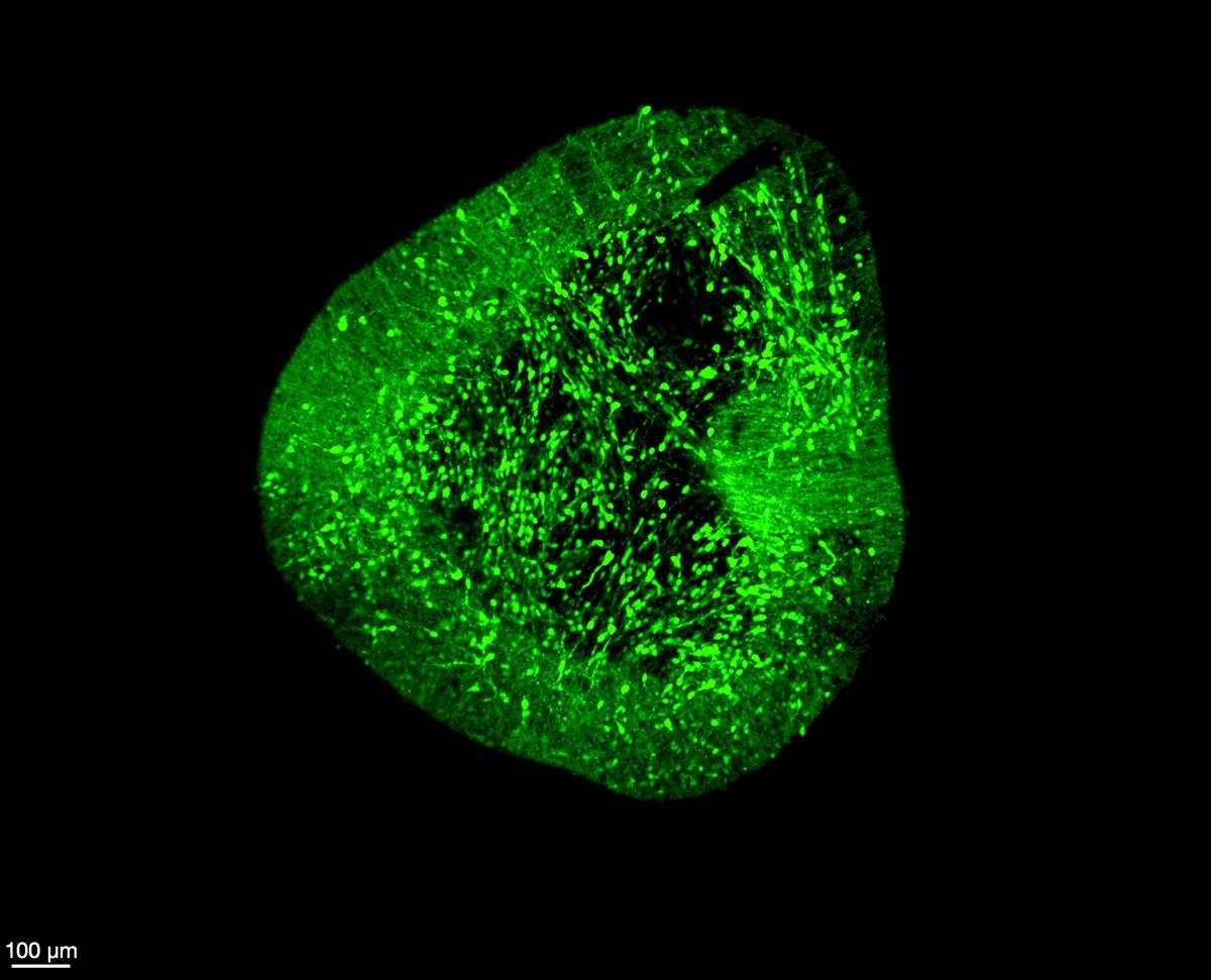 Midbrain dopaminergic neurons under a microscope (Image credit - Hilary Toh, Duke-NUS Medical School)