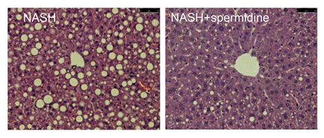 Deoxyhypusine hydroxylase (DOHH) Deoxyhypusine hydroxylase (DOHH) is a key enzyme that utilises spermidine to catalyse a specific chemical modification (i.e. post-translational hypusination) of the translation factor EIF5A (EIF5AH).