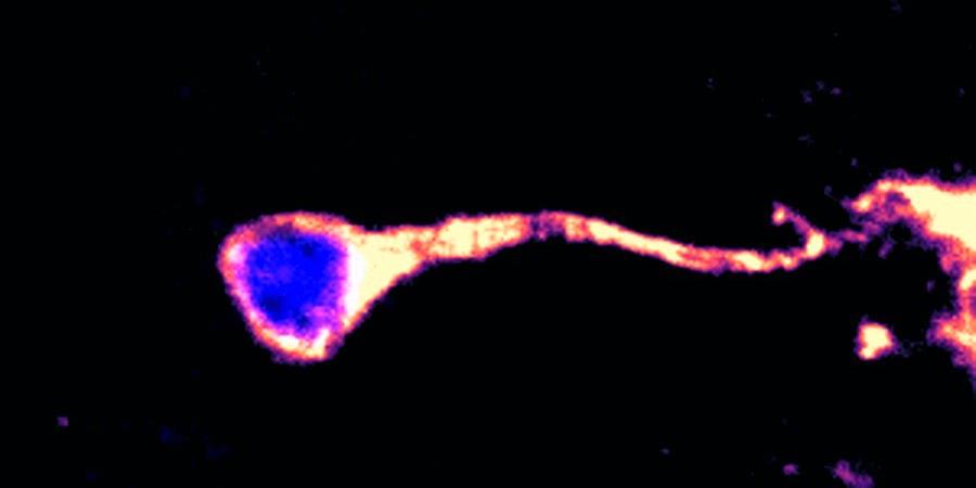 Image of a single quiescent neural stem cell with its hallmark cellular protrusion extending from the cell body from Drosophila larval brains six hours after larval hatching, with the membrane in orange and nuclear marker in blue Image of a single quiescent neural stem cell with its hallmark cellular protrusion extending from the cell body from Drosophila larval brains six hours after larval hatching, with the membrane in orange and nuclear marker in blue
