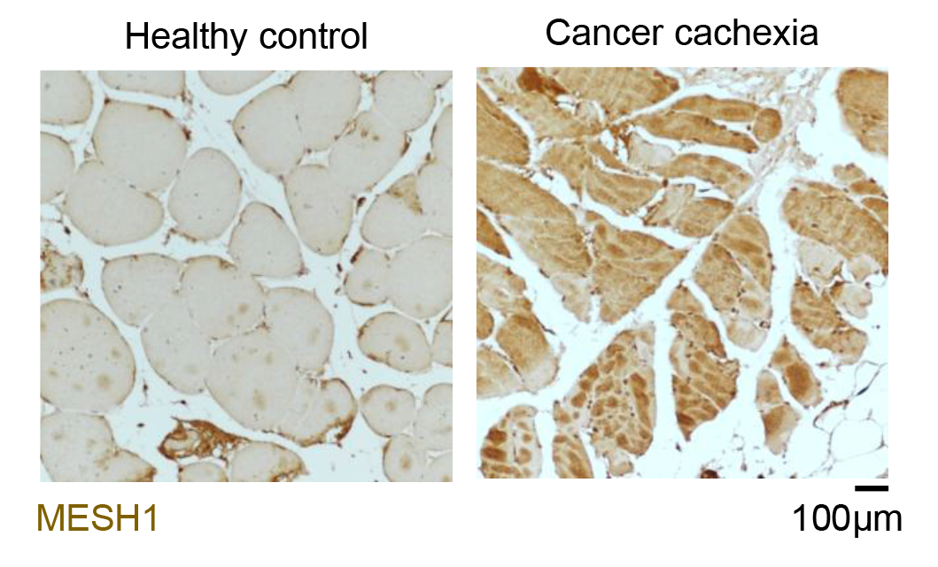 Human Muscle tissue samples were stained brown to show where the MESH1 enzyme is present—the darker the brown, the more MESH1.