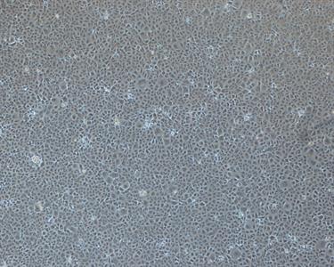 Healthy monkey kidney cells Healthy monkey kidney cells