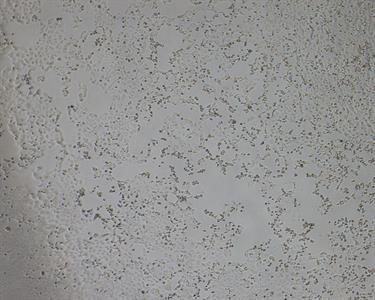 Cell death after infection with the novel coronavirus Cell death after infection with the novel coronavirus