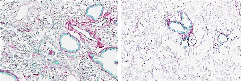 Lung tissue showing scarring in an induced fibrosis model (right); while WWP2 inhibition protects tissue structure from fibrosis (left) // Image credit: Chen Huimei, Duke-NUS Medical School Lung tissue showing scarring in an induced fibrosis model (right); while WWP2 inhibition protects tissue structure from fibrosis (left) // Image credit: Chen Huimei, Duke-NUS Medical School