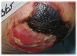 Picture1