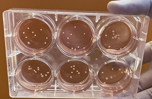 astar_scientists-grow-miniature-brains_1000x650 astar_scientists-grow-miniature-brains_1000x650